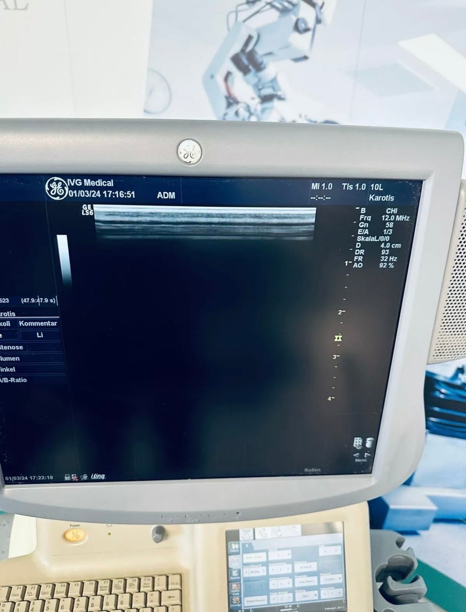 GE Logiq S6 Ultraschallgerät + 3 Sonden E8C, 3.5C, 10L, 4D