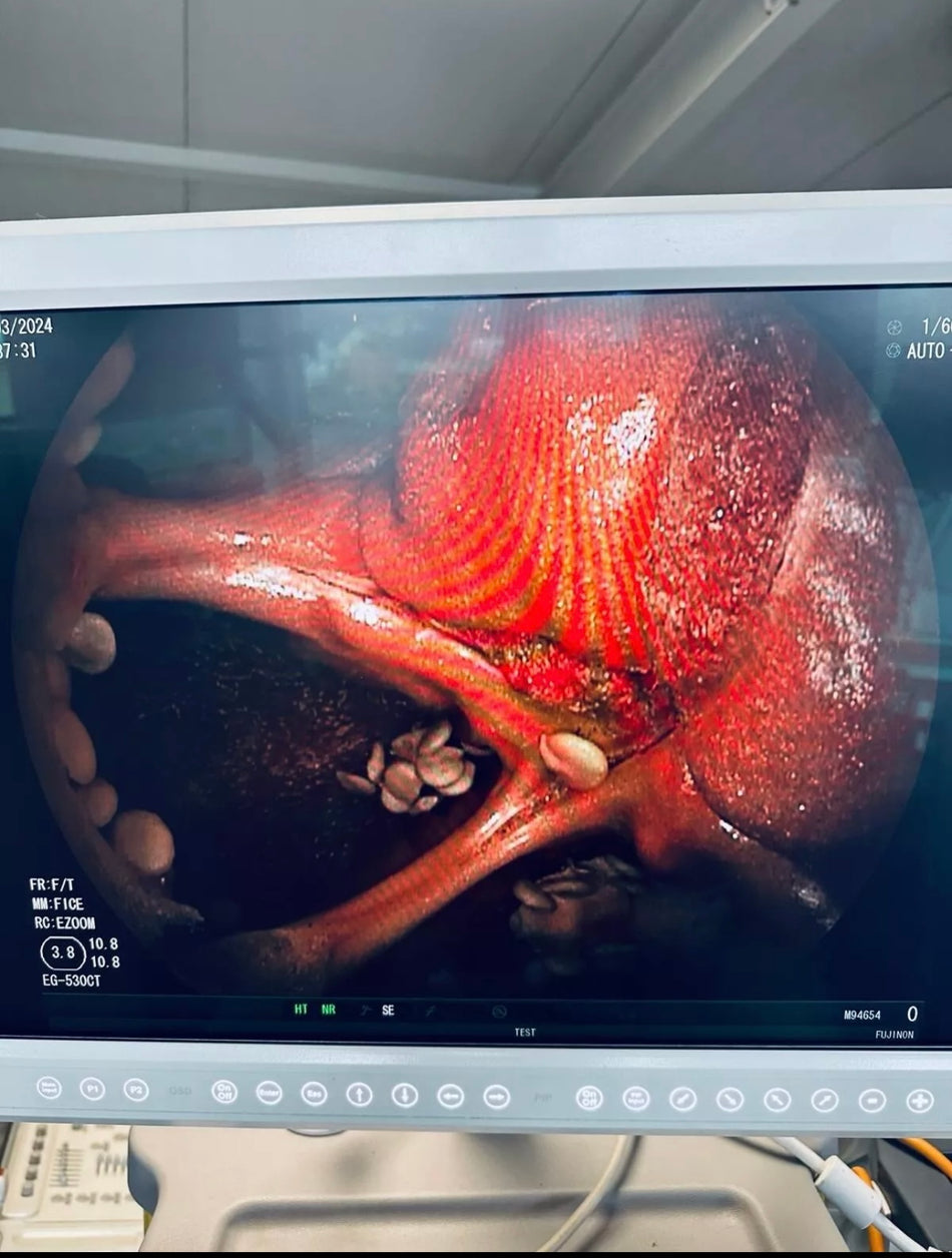Fujinon EG-530CT Videogastroskop Endoskop
